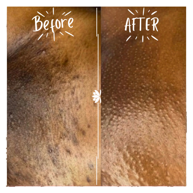 The Future of Waxing: From Hair Removal to Skin Solutions